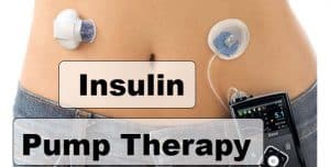 Everything You Need To Know About Insulin Pump Therapy