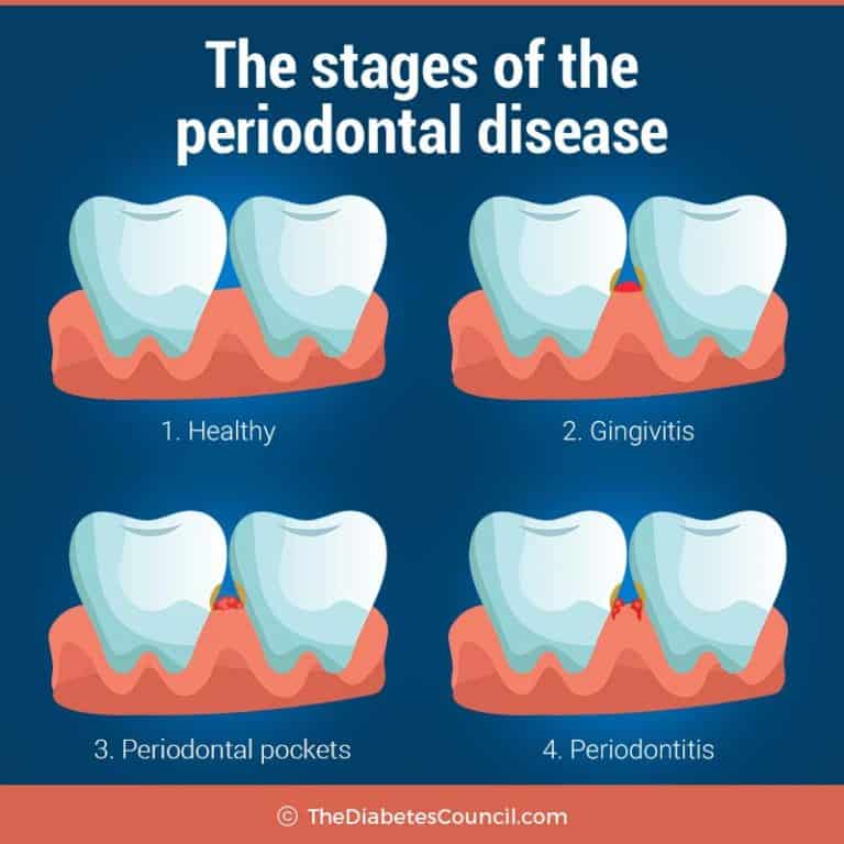 Can Diabetes Affect Your Teeth And Gums?