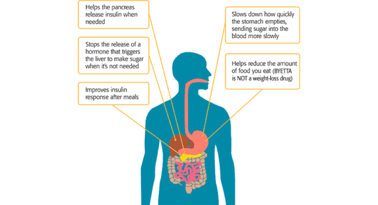 Byetta (Exenatide) for Type 2 Treatment: Comprehensive Review ...