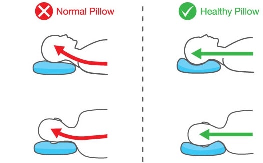 type of pillow for neck pain